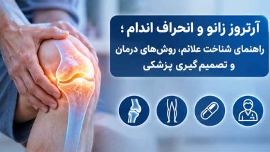 آرتروز زانو و انحراف اندام؛ راهنمای شناخت علائم
