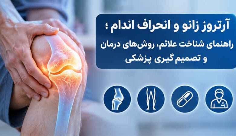 آرتروز زانو و انحراف اندام؛ راهنمای شناخت علائم