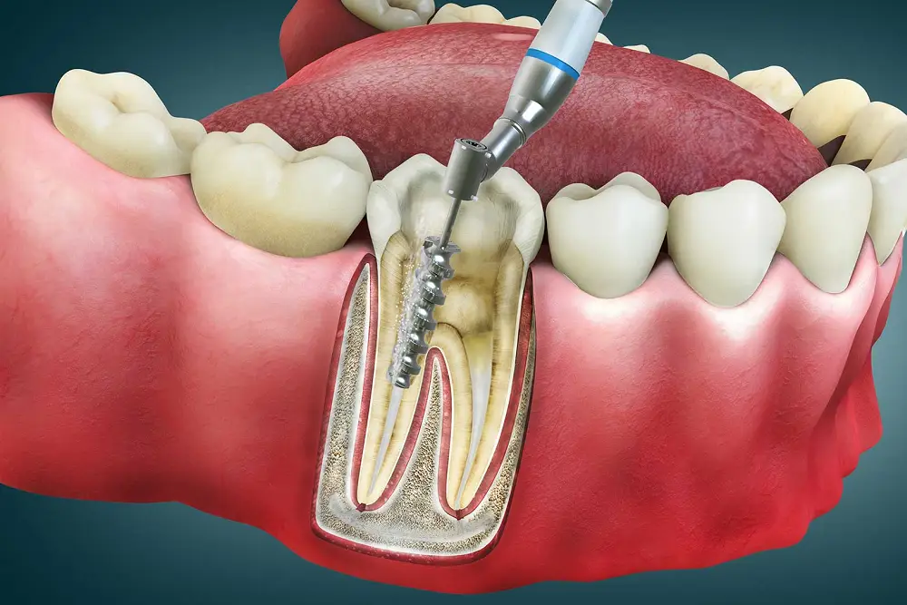 خدمات دندانپزشکی در کرج